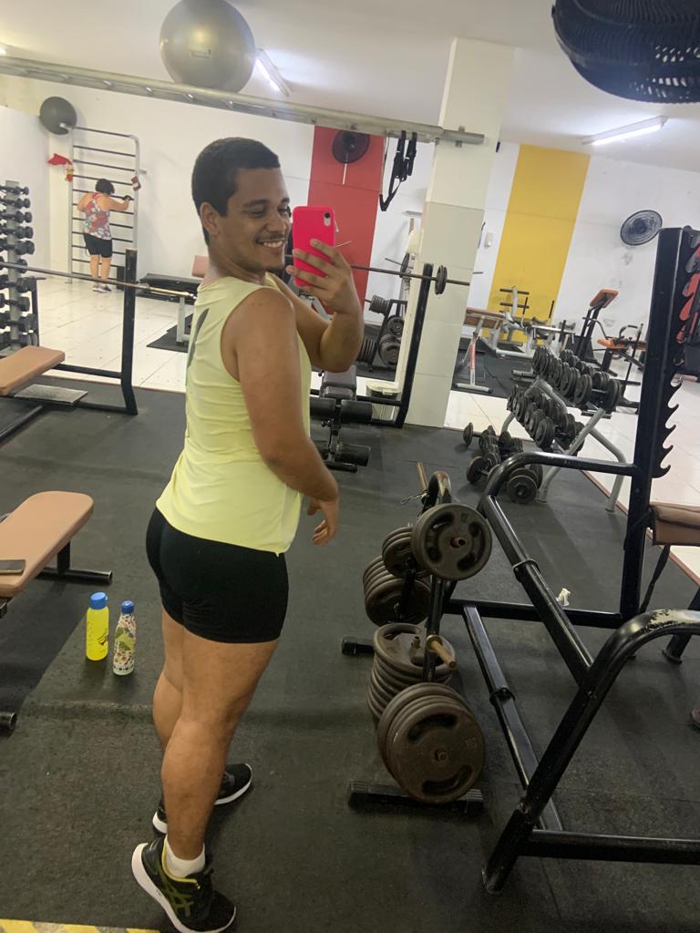 As marcas do seu corpo contam a sua história. Isso é precioso demais para ser esquecido e não ser amado!