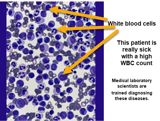 mls2030's tweet photo. Medical laboratory scientists.
Meaningful work.  Career growth

#mls2030 #stemcareers #laboratorycareers #medtech #labtech https://t.co/3e6ugpzvU5