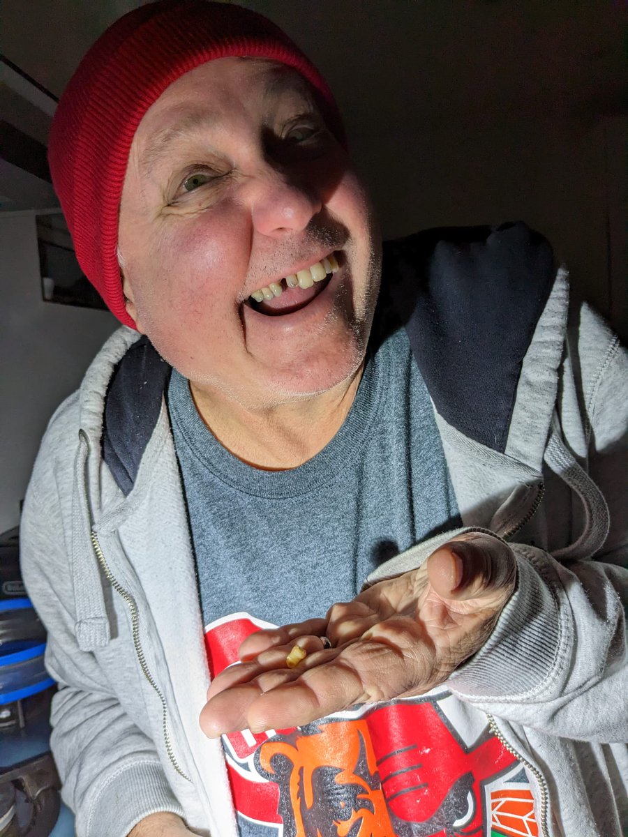 SkydMarxx's tweet photo. Just lost my last baby tooth. 66 years, 3 months, 14 days. Top that!  #HarryandMeghan #AndrewTate #RichardCurtisBlows https://t.co/FuhpkdnGci