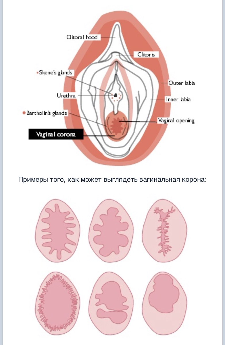 _OneLostDay's tweet image. Мифы о девственной плеве были созданы для того, чтобы контролировать женскую свободу и сексуальность. Единственный способ борьбы с этим – распространение знаний. ↘️