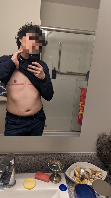 Was at a party last night, thought I looked good :) https://t.co/yOx4gD0BYg<a href="/tag/sexy"class="tags"><span>#sexy</span></a><a href="/tag/hot"class="tags"><span>#hot</span></a><a href="/tag/sex"class="tags"><span>#sex</span></a><a href="/tag/underwear"class="tags"><span>#underwear</span></a><a href="/tag/nude"class="tags"><span>#nude</span></a><a href="/tag/horny"class="tags"><span>#horny</span></a><a href="/tag/queer"class="tags"><span>#queer</span></a>