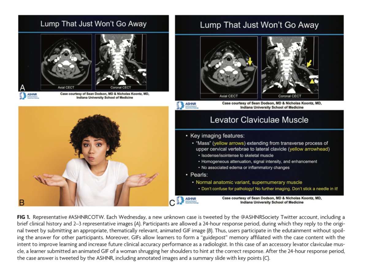 “A Gamified Social Media–Based Head and Neck Radiology Education Initiative of the American Society of Head and Neck Radiology: Viewership and Engagement Trends at 3 Years” #Gamification #FellowsJournalClub #OpenAccess <a href="/nakoontz/">Nicholas Koontz</a> <a href="/ASHNRSociety/">ASHNR</a> | bit.ly/3VlTFyE