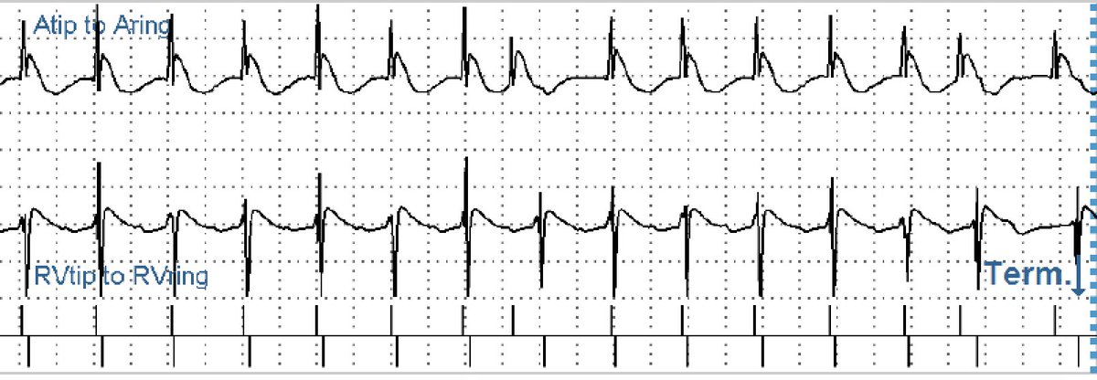 Mark Perrin tweet media
