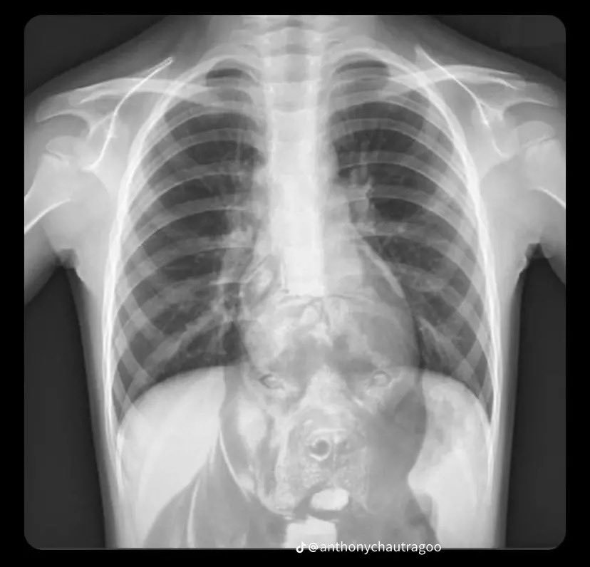 the_mattattackk's tweet photo. Idk why they sent me your X-rays from your accident I hope you're good https://t.co/mGR4PWuPpj