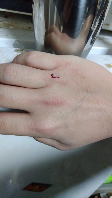 栓抜き買うか検討中 