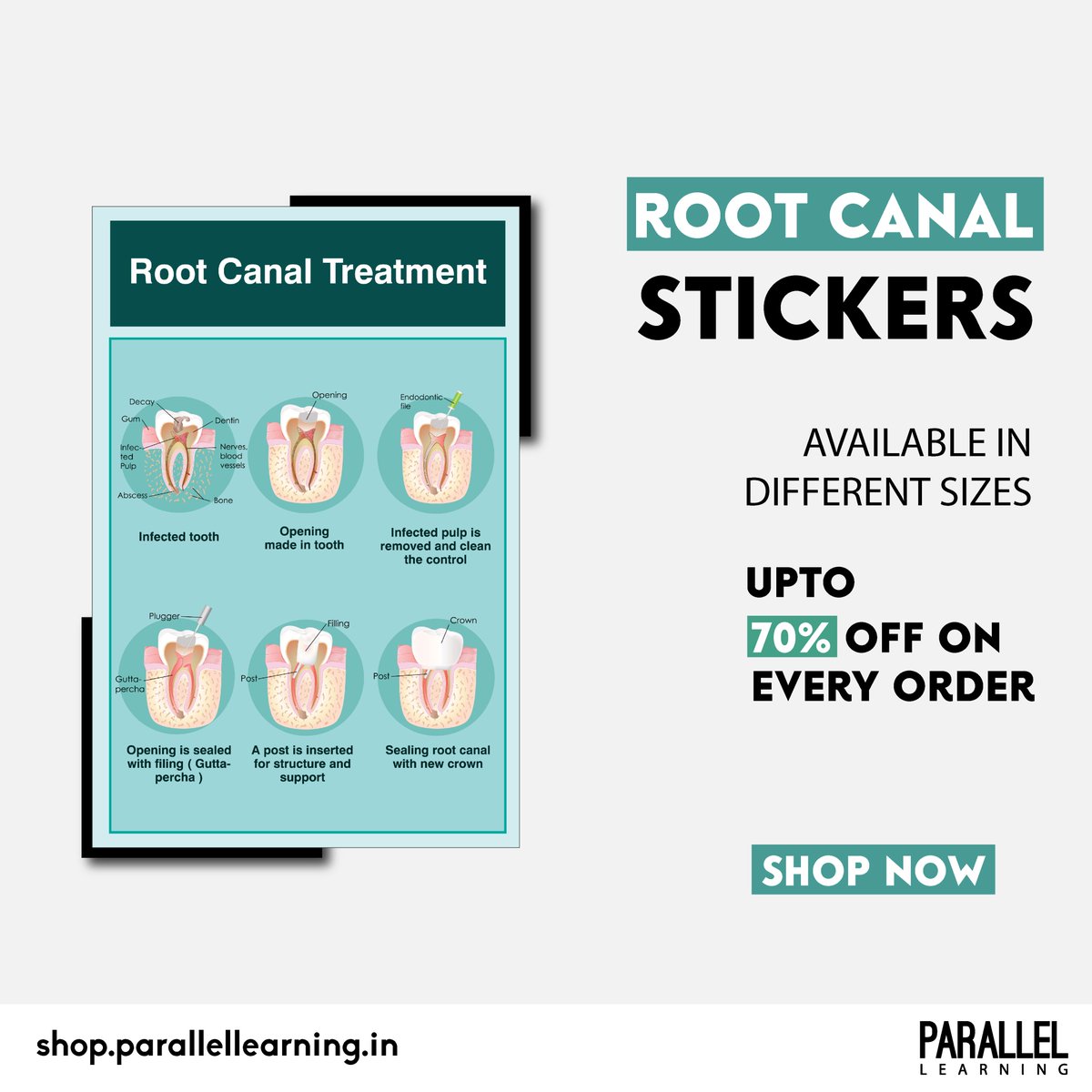 Root canal treatment process stickers & posters for dental clinic. 
Features-
✅Premium quality 
✅waterproof 
✅Starting at Rs- 65/- Only
✅COD Available (INDIA)
.
.
shop.parallellearning.in/collections/de…
#dentist #dentistry #smile #teeth #dentista #tooth #dentalclinic #ParallelLearning