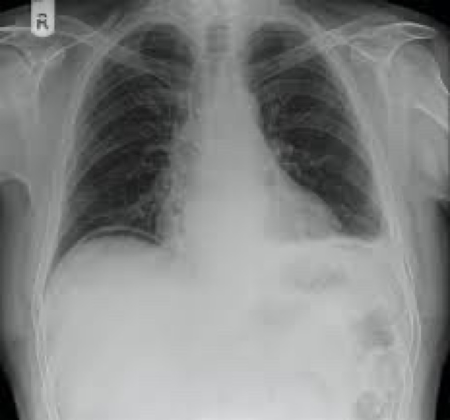 Brown Hospital Medicine on Twitter: