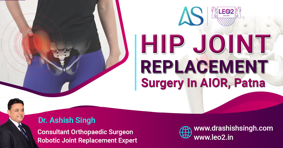 Bone_Specialist's tweet photo. Hip Joint Replacement Surgery in AIOR, Patna
#hipreplacement #discsurgeryinpatna #discprolapseatorthoaiorhospital #bodytreatment #besthospitalinpatna #discprolapsesurgery #discprolapse #painrelief #backpain #artificialdiscreplacement #orthopedicsurgery #drashishsingh https://t.co/qBq4rPia4s