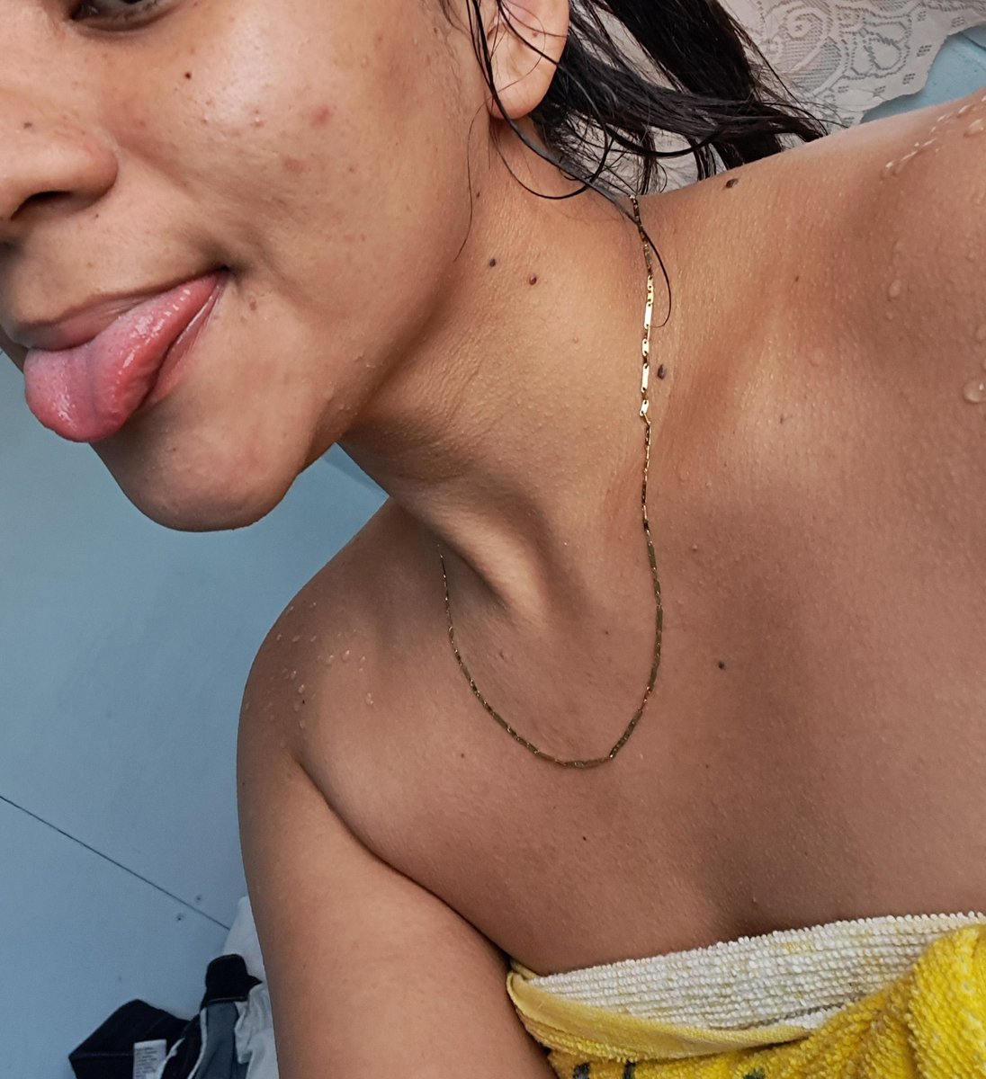 Que bonitas mis espinillas y mis lunares 🍪🍓🤎✨️