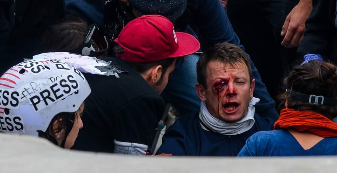 AnonymeCitoyen's tweet photo. Le CRS jugé pour avoir éborgné Laurent Théron, syndicaliste et secrétaire hospitalier lors d'une manifestation contre la loi travail en 2016 à Paris a été définitivement acquitté suite à la décision du ministère public de ne pas faire appel https://t.co/j3Kz67UvVM