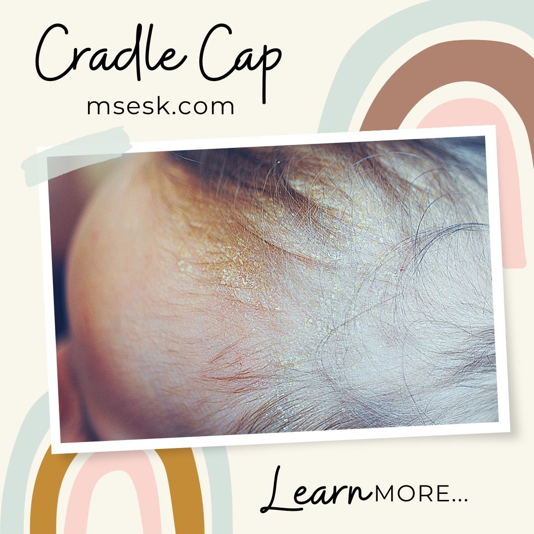 AaronSecrestMD's tweet photo. It's been #months since I added a #new #medicalsecret - sorry about that, but my #freetime was non-existent. Just posted on #cradlecap - common issue in #babies - https://t.co/JktO4Dl9fP
#msesk #dermatology #dermatologist #dermatologia https://t.co/EXQN2aBX5B
