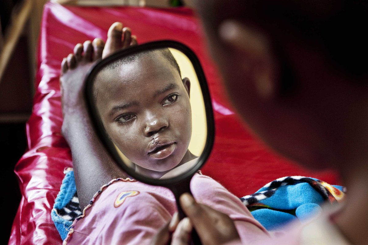 OpSmileSA's tweet photo. With your help we can transform the life of a child born with a cleft condition in as little as 45 minutes!
Click on link https://t.co/QD5oeWM50b to DONATE a SMILE. #GiveSmiles #cleftproud #opsmilesa https://t.co/GXsPTINnlC