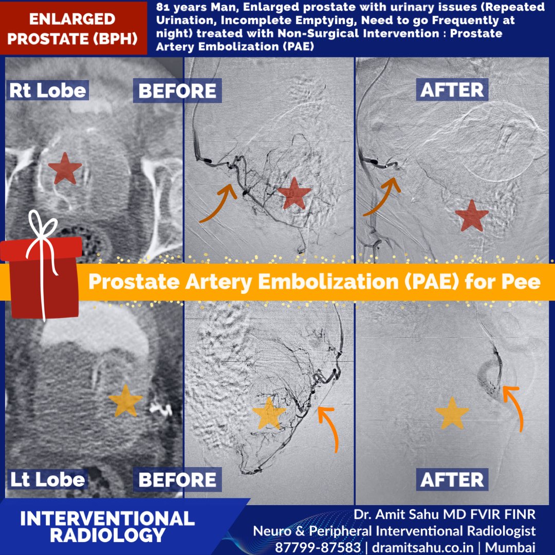 Dr. Amit Sahu MD FVIR FINR tweet media