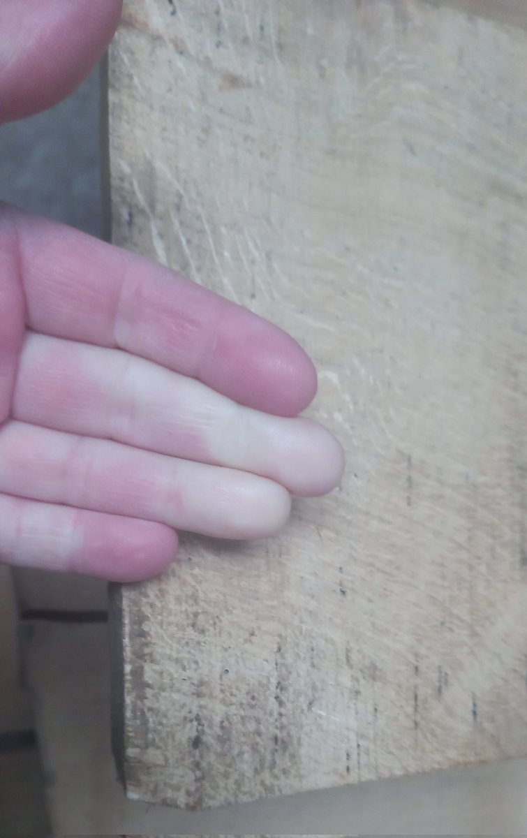 Forest2Furnitur's tweet photo. It's ever a good idea to start changing the planer blades when this happens.
Gloves are not an option.
#raynaulds https://t.co/b3hityvg7e