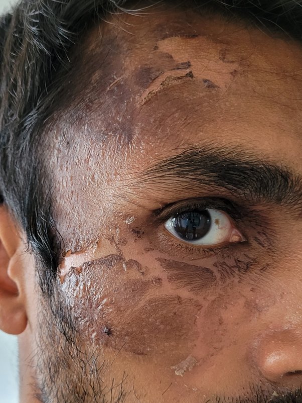 MPSLadyMargaret's tweet image. A male who threw scalding water at officers has pled guilty to assault on an emergency worker x 2 and a racially aggravated public order offence. He was sentenced to 26 weeks imprisonment suspended for 2 years, with £350 and £150 compensation for the officers involved.