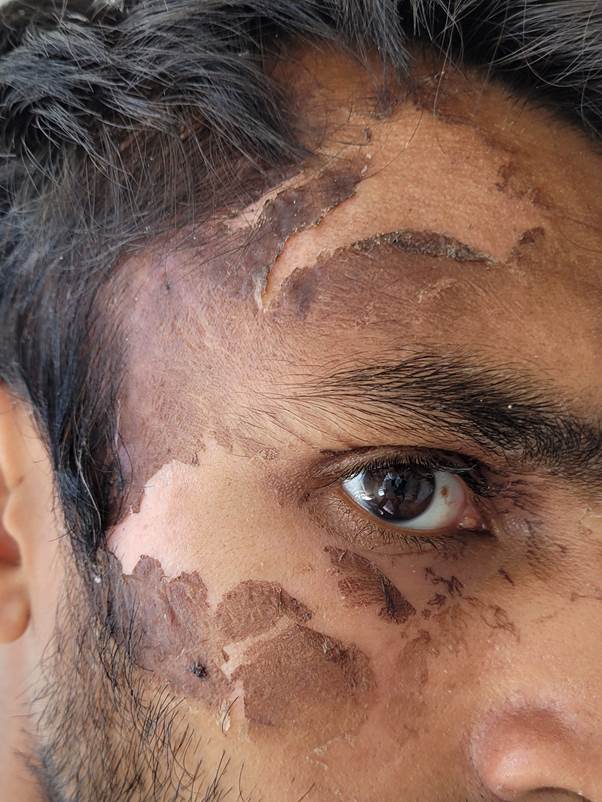 MPSLadyMargaret's tweet image. A male who threw scalding water at officers has pled guilty to assault on an emergency worker x 2 and a racially aggravated public order offence. He was sentenced to 26 weeks imprisonment suspended for 2 years, with £350 and £150 compensation for the officers involved.