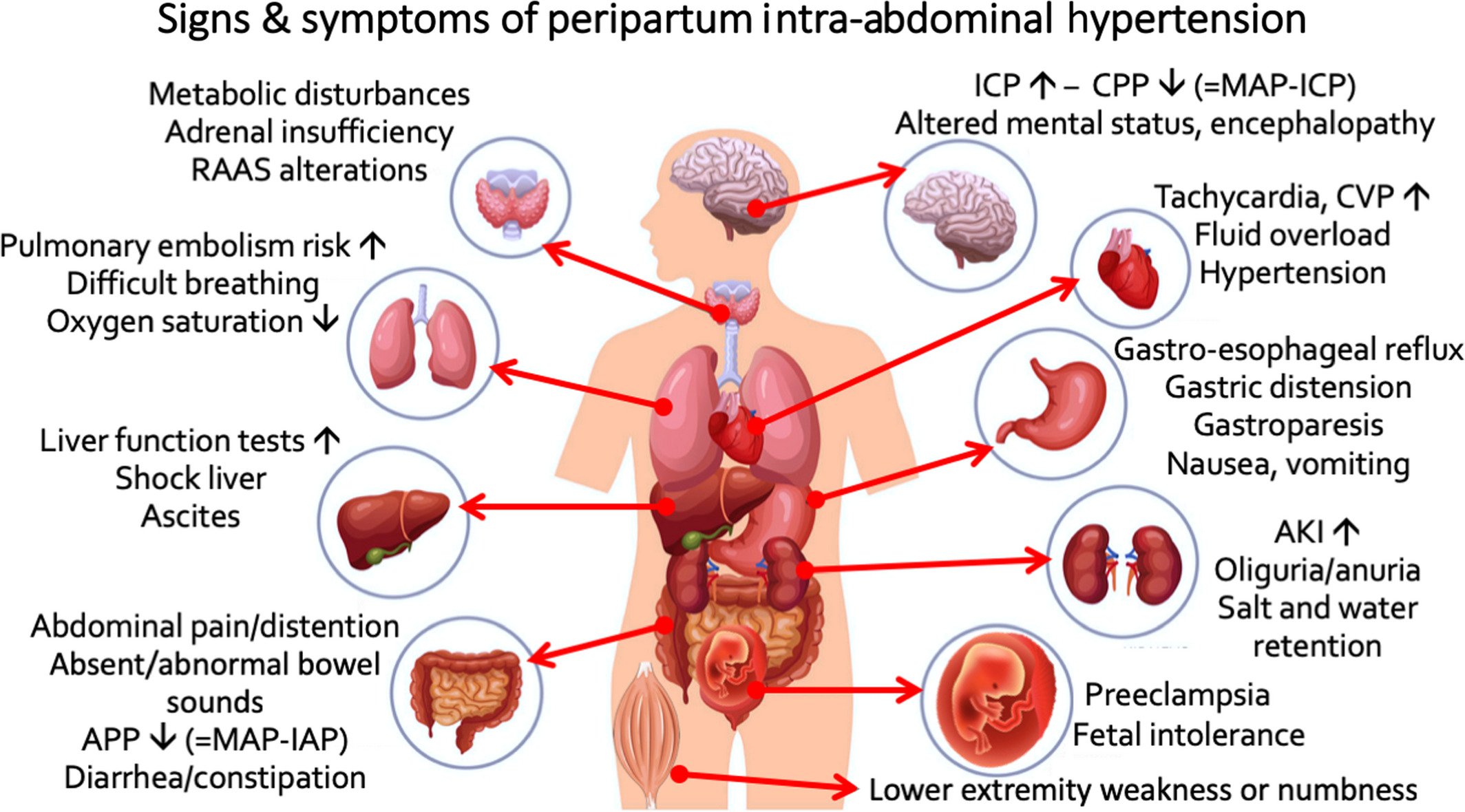 Distensión abdominal síntomas
