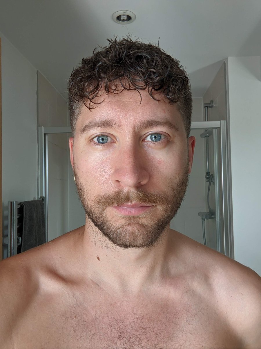mjsouthward's tweet photo. Bites. https://t.co/SinxjCN7mx