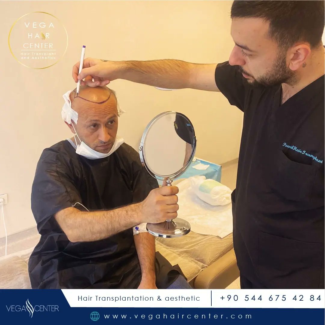 VegaCenter's tweet photo. Hair transplant with advenced technology methood Fue+sapphire 2900 grafts 
🌐https://t.co/7EUrV84CTg 
🇹🇷🇬🇧📞+90 544 675 42 84 
🏨 Location :istanbul 
💉 Anestesi:Local Anestezi https://t.co/MC8YPIl0Yn
