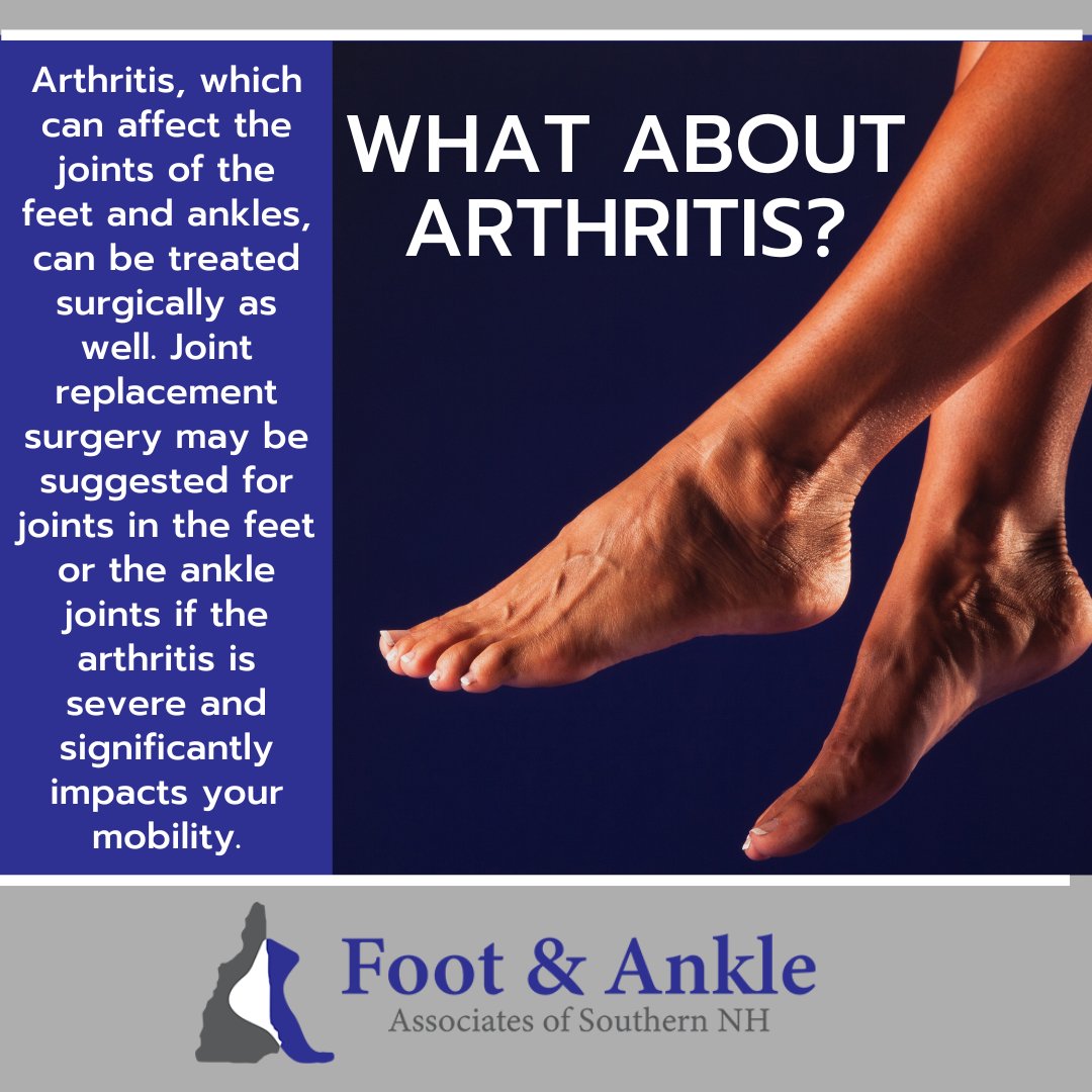 If you have a foot or ankle condition, please consult with a podiatrist, who can determine which type of treatment is right for you.
.
.
.
#footsurgery #arthritis #footarthritis #podiatrypractice #bestdoctors #bestpodiatrists #FootAndAnkleAssociatesOfSouthernNewHampshire #FAASNH