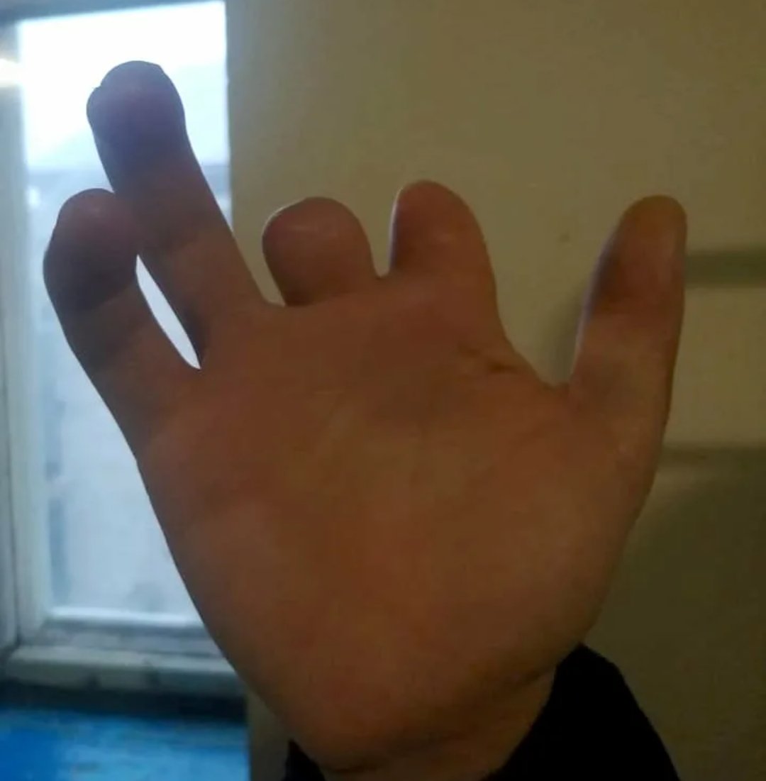 Прищемила палец дверью машины
