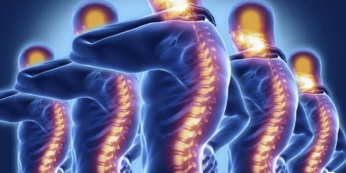 HamidMirMD's tweet photo. According to the WebMD, almost 80% of people will suffer from back pain at least once during their lifetime.

https://t.co/HpsIne20EA https://t.co/K8nszr1hWW