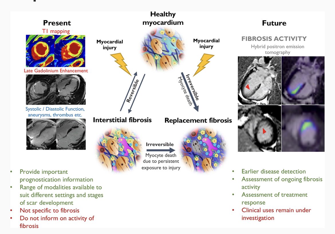 AnnaKateBarton's tweet image. Pleased to present our review article discussing the present and future of molecular myocardial fibrosis imaging. Interested to learn now novel PET tracers may change the field? Read on to learn more 👓 📚 

#whyCMR #multimodalityimaging #cardiotwitter

doi.org/10.1093/ehjci/…