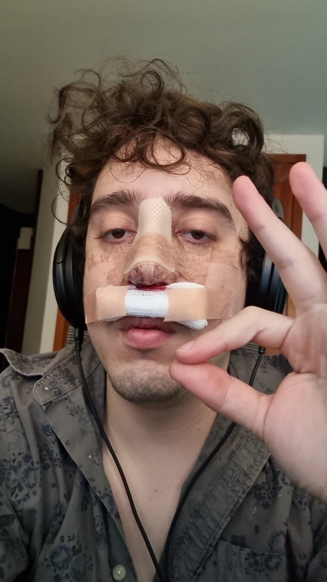 Para los que preguntan que me pasó: me opere del tabique por que lo tenía desviado, salu2