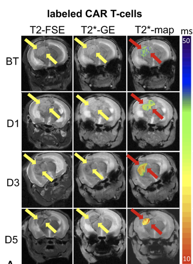 PedsMIPS's tweet photo. Congratulations to Dr. Emma (Wei) Wu &amp; team for publishing their article on CAR-T cell imaging in Investigative Radiology: https://t.co/CikqzaL5zm #SocPedRad #RSNA #WMISWMIC #AACR #ISMRM #intskeletal #officialEANM #SNM_MI https://t.co/bNetZNJVxu