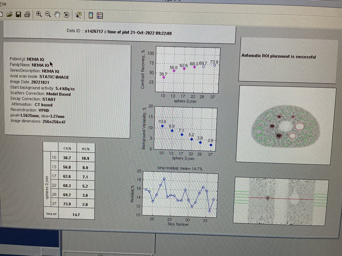 BlogMedNuclear's tweet photo. PET/CT - Image quality #nuclearmedicine #medicinanuclear #medicalphysics #fisicamedica 

Voltando… https://t.co/TCUx1ctTKD