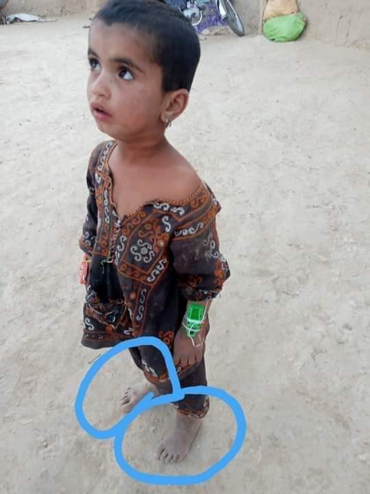 IrfanZehri100's tweet photo. Don't forget such people around you in this severe cold, come forward and support us so that warm clothes and sweaters can be delivered to these people.
Contact.
03361868148
#Zehri #WinterclothesDrive
@ArmedWithWords @KazmiSyed_PTI @Misa72_1 @waqas_amjaad @KazmiWajahat https://t.co/n07U9dy3Jt