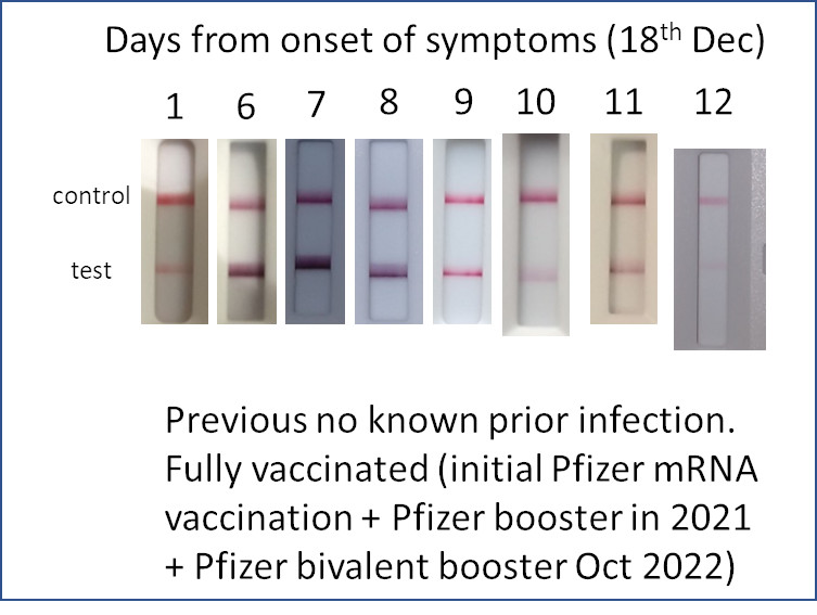 CMc_positive's tweet photo. Not the 12 days of Xmas I wanted; at least symptoms are mild. Wonder if duration of shedding for those who have dodged infection until now has shifted due to viral evolution as was surprised to be +ve for so long, but perhaps I am the outlier instead! https://t.co/QsNB9tPQo5