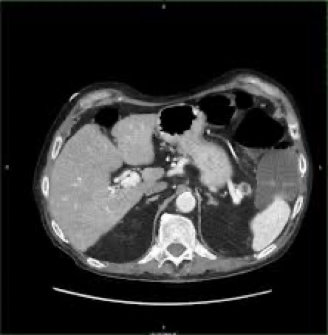 Brown Hospital Medicine on Twitter "A 50yearold woman presents with