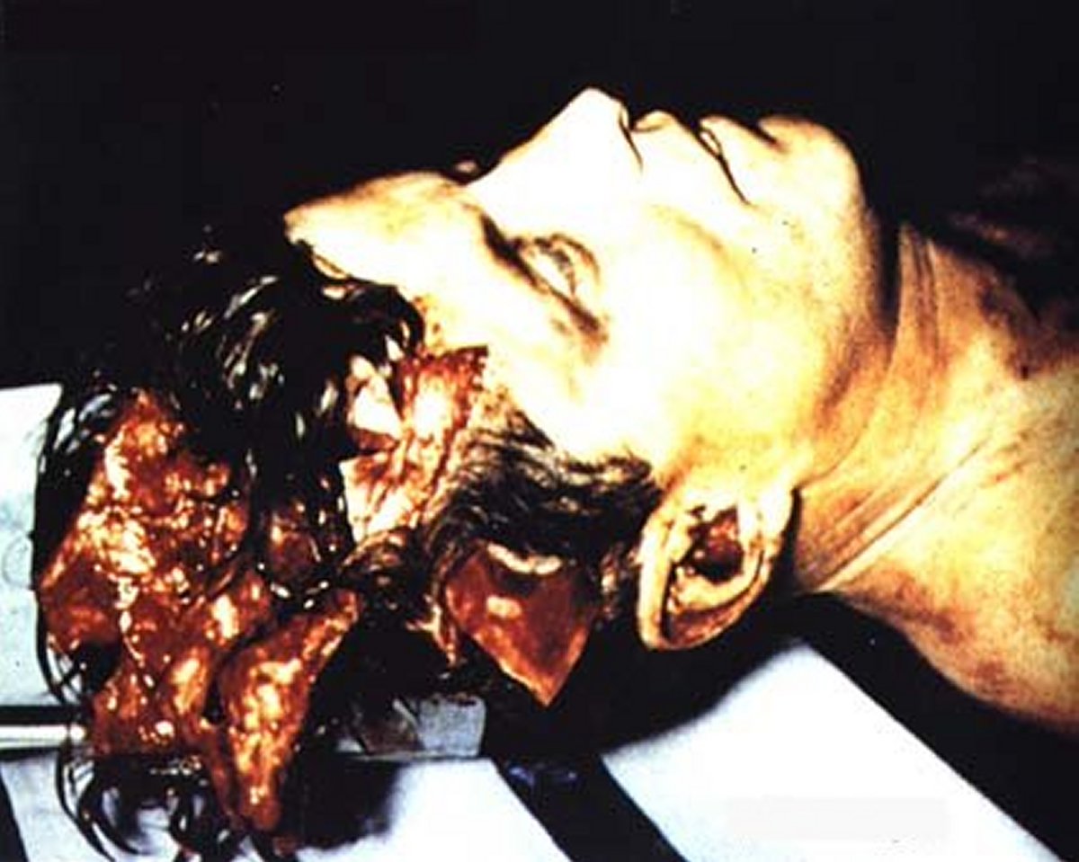 Rex_Luciferius's tweet photo. 1/1 Death NFT of JFK from my Death Series
Famous Death Images from my 1999 Cult Classic Film
Best Death Gallery
FBI Autopsy Photo Proves JFK Shot from Front
https://t.co/nM4PbT2wg3

#jfk #jfknft #death #deathnft #deathart #nft #nfts #nftcommunity #nftcollectibles #nftcollectons https://t.co/v2fW26zOmb