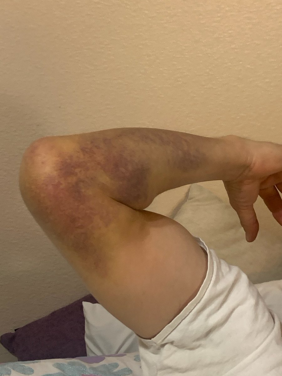 Steve Huskey tweet media