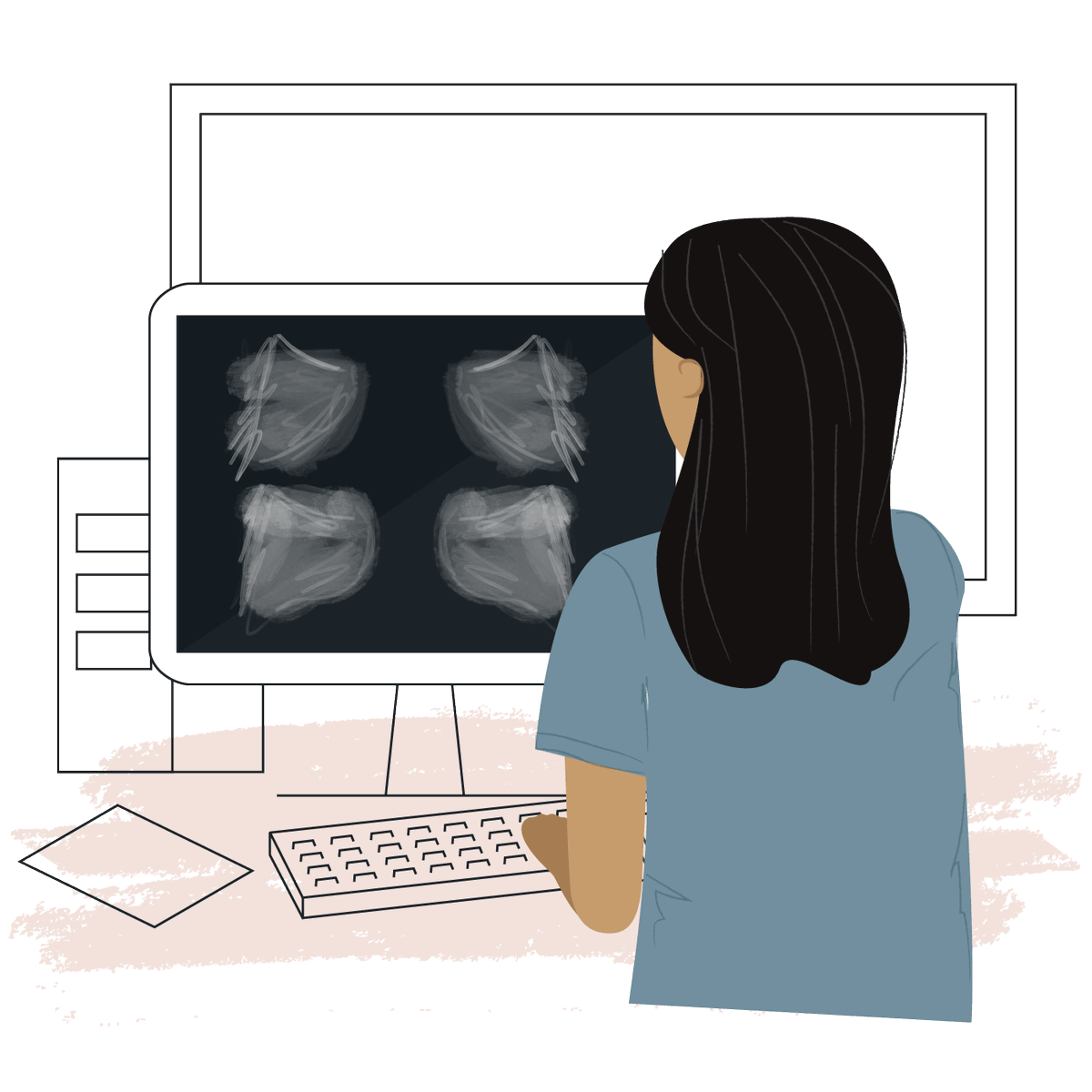 WRDensity is our #AI-driven software that assists radiologists in interpreting #breastdensity to create uniformity of density assessments at a practice level. The goal: to aid in early detection + give patients peace of mind. Learn more: whiterabbit.ai/products/wrden… #radiology