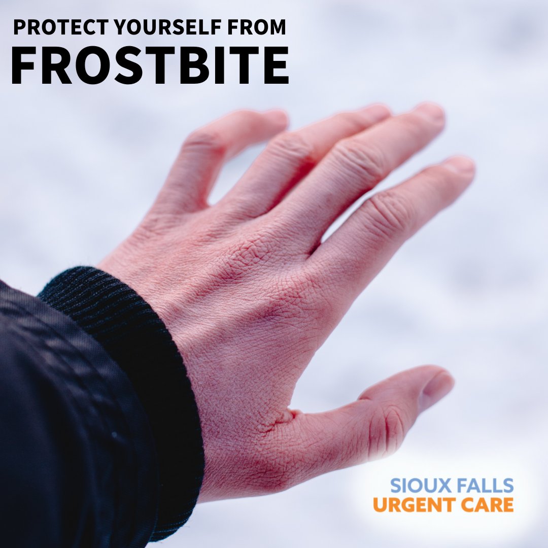 How to protect yourself against frostbite and steps to take if you need medical help. 

sfsh.com/blog/is-it-fro…