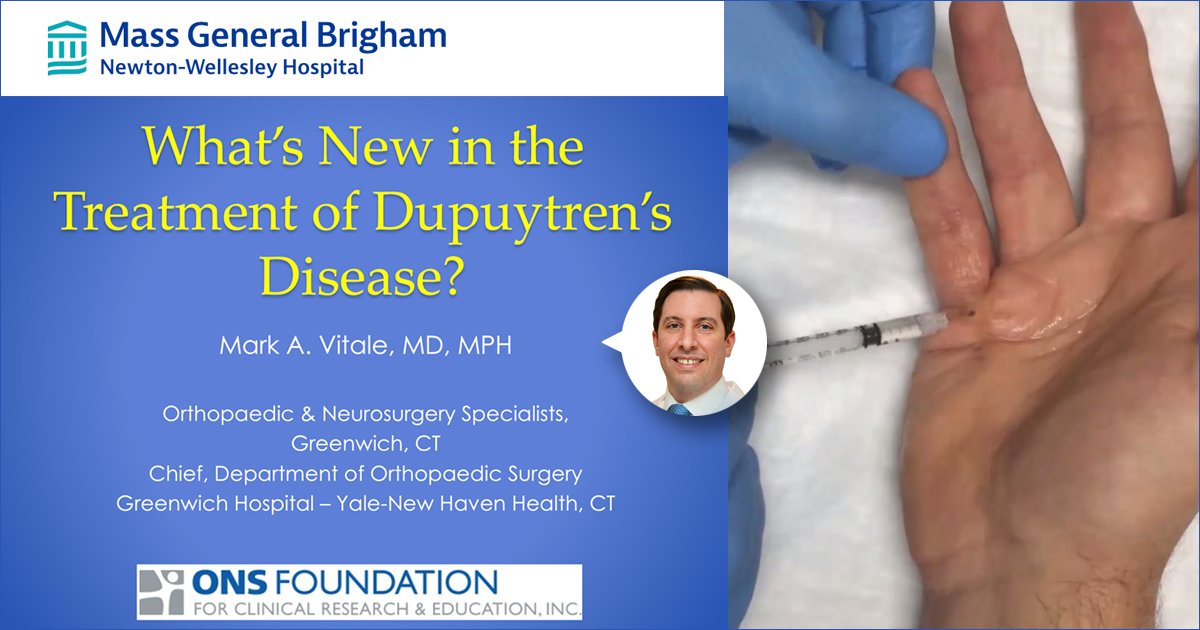 Thanks to the Department of Orthopedics at Newton-Wellesley Hospital and especially Dr. David Ruchelsman for inviting me to present Grand Rounds last week on what we are learning about the treatment of Dupuytren's disease of the hand. #Dupuytrensdisease #handsurgeon