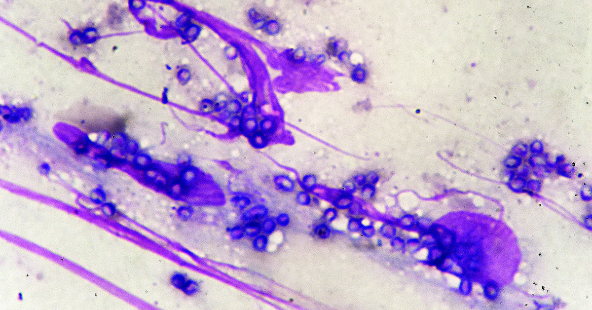 CLN_ADLM's tweet photo. IMMY has been awarded a $1.5 million National Institute of Allergy and Infectious Disease contract for developing and validating a talaromyces point-of-care test. https://t.co/42IKwChaYT https://t.co/qSBATBa3S0