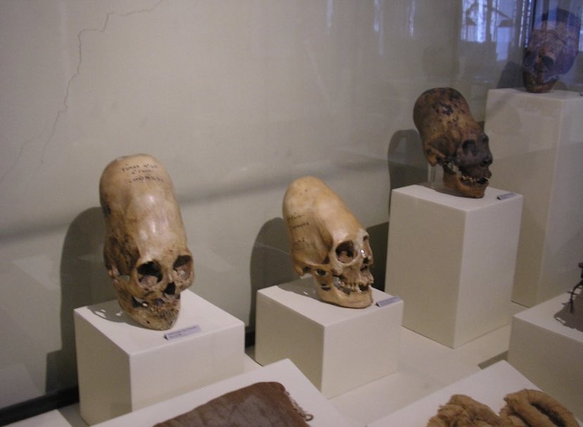Yeetus__maximus's tweet photo. Here’s an example of the Paracas elongated skulls.  
This is an example of artificial cranial deformation, usually achieved by applying force to an infants developing head. It’s said they did this to imitate their gods. https://t.co/RBFOq4mtWD