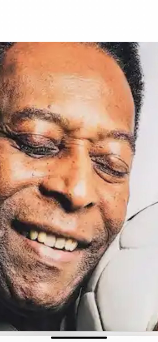 ♥️Pele…..