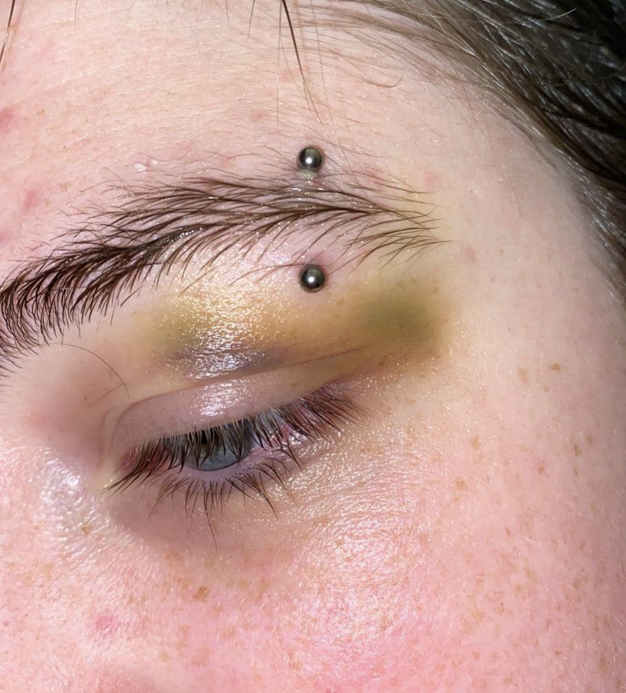 haley (emo) on Twitter "anyways i got my eyebrow pierced"