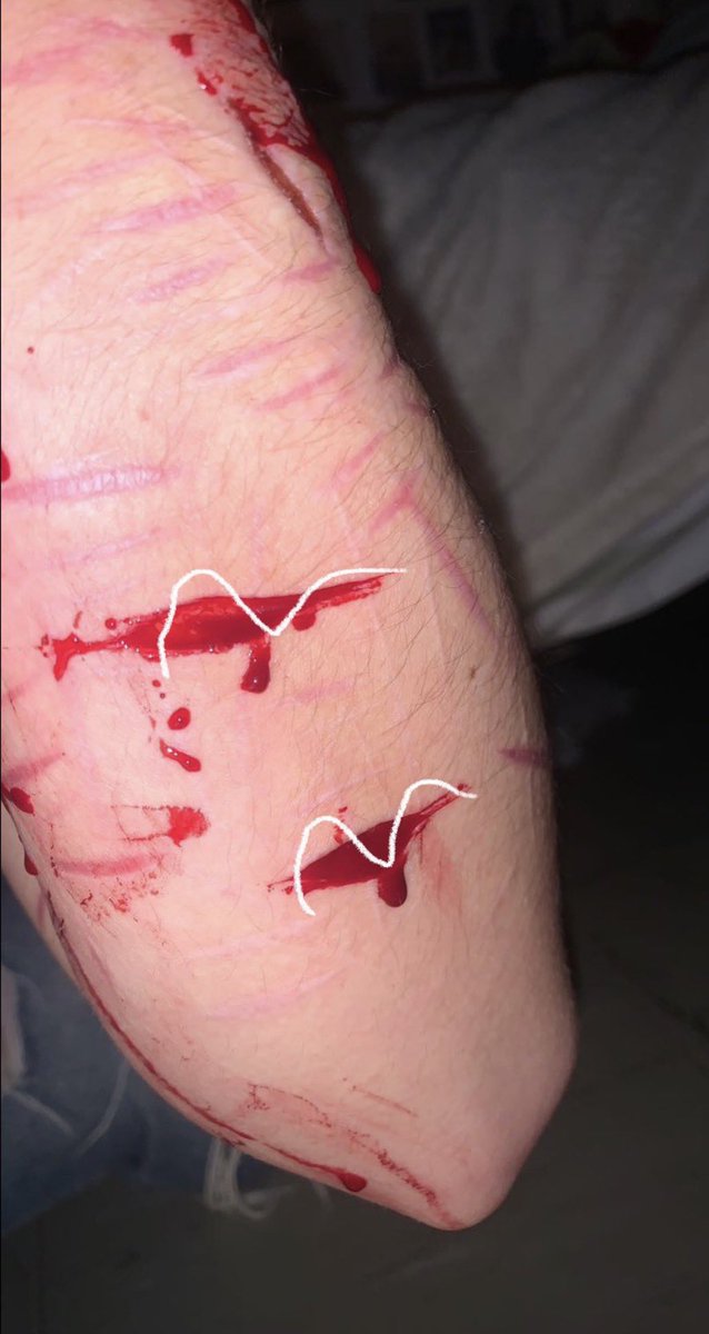 goretwtlily's tweet photo. (tw) 
SFX M@KE UP ALL FAKE !! 
SFX FOR MOVIE PRÖPS!
almost looks real (not mine)
credit in the comments! 
fake fake fake fake fake fake fake

follow @/obcenetwtt ( alt  ) https://t.co/zeb3PHbO3o