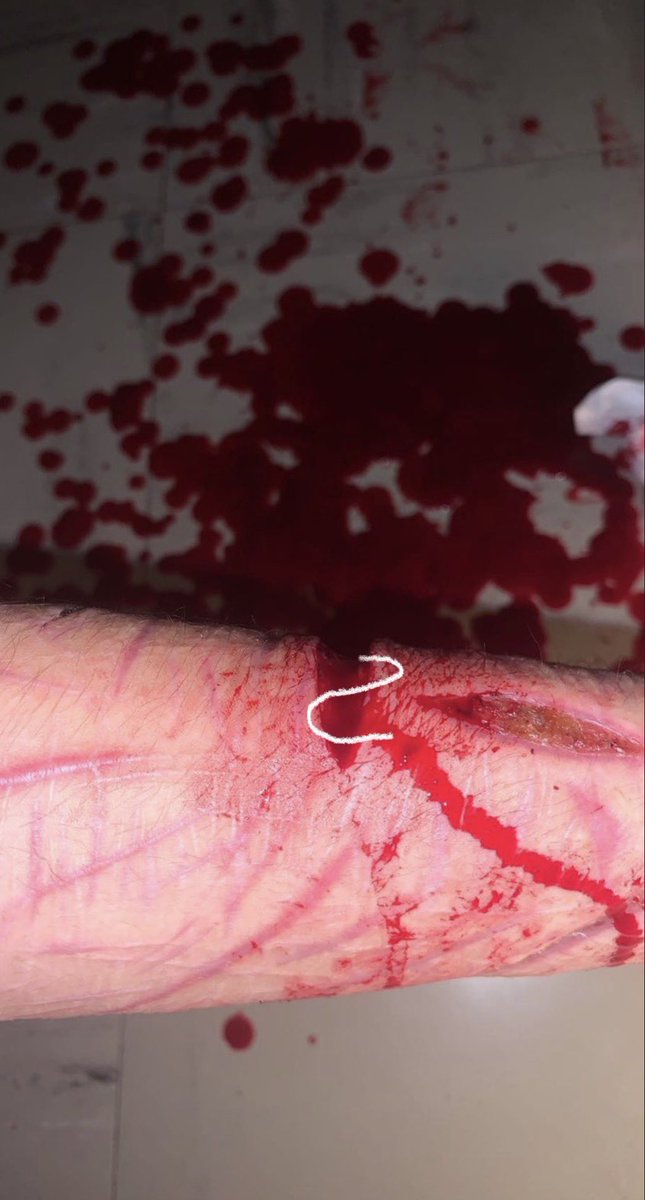 goretwtlily's tweet photo. (tw) 
SFX M@KE UP ALL FAKE !! 
SFX FOR MOVIE PRÖPS!
almost looks real (not mine)
credit in the comments! 
fake fake fake fake fake fake fake

follow @/obcenetwtt ( alt  ) https://t.co/zeb3PHbO3o