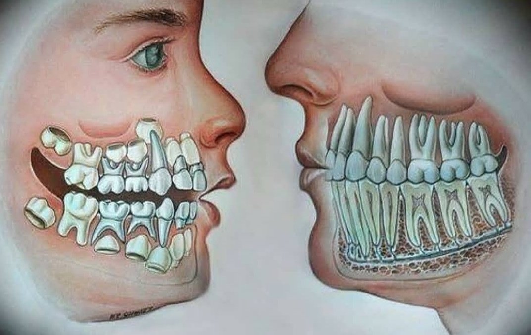 odontorz's tweet photo. Dentición de un niño vs la de un adulto. https://t.co/ky30gLdKua