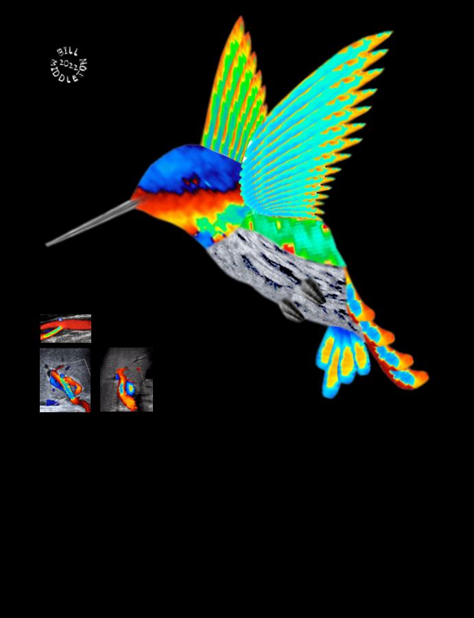 Happy Holidays!  Enjoy this beautiful artwork by Dr. Bill Middleton.  Dr. Middleton created this piece from #ultrasound images and was inspired by the #SRU22 Plenary Session "Advancing the Art of Ultrasound".  <a href="/MIRimaging/">WashUMedMIR</a> <a href="/nirvidahiya/">Nirvi Dahiya MD, FACR, FSRU, FAIUM</a> <a href="/ayakamaya/">Aya Kamaya, MD</a> <a href="/mpcaserta/">Melanie P. Caserta, MD</a>