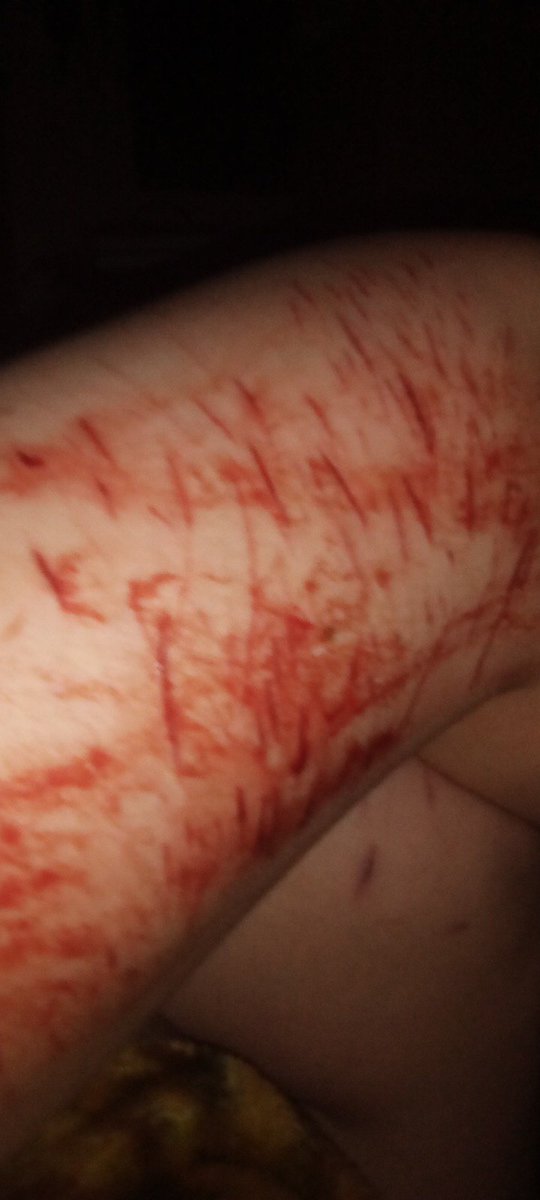e_gg_s__'s tweet photo. shower cuts <3 babybeanstwt beanstwt catscratchtwt styrotwt raspberryfillingtwt https://t.co/bsFELSNU6R