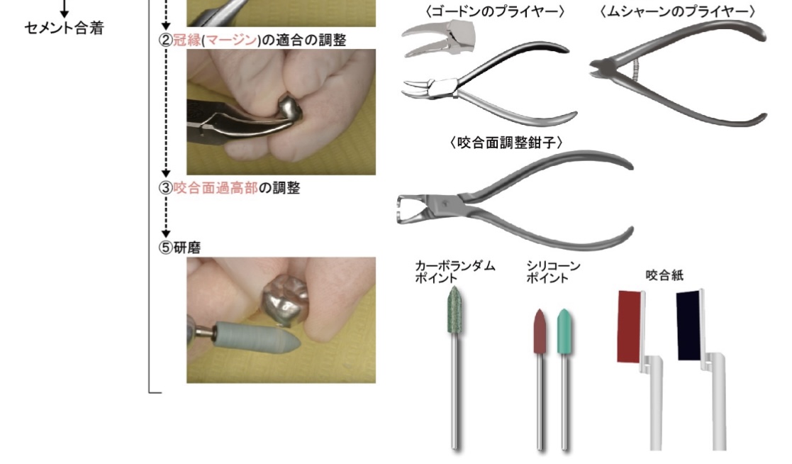 歯科技工 サンキン 乳歯冠 上下 です。 歯科用 ANATOM PRIMARY CROWNS