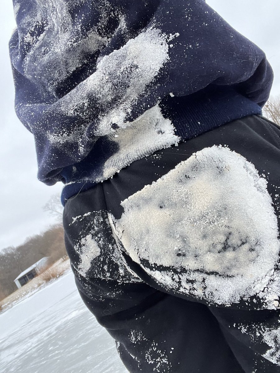 You get to fall on your face, your back, your knees, and your pride