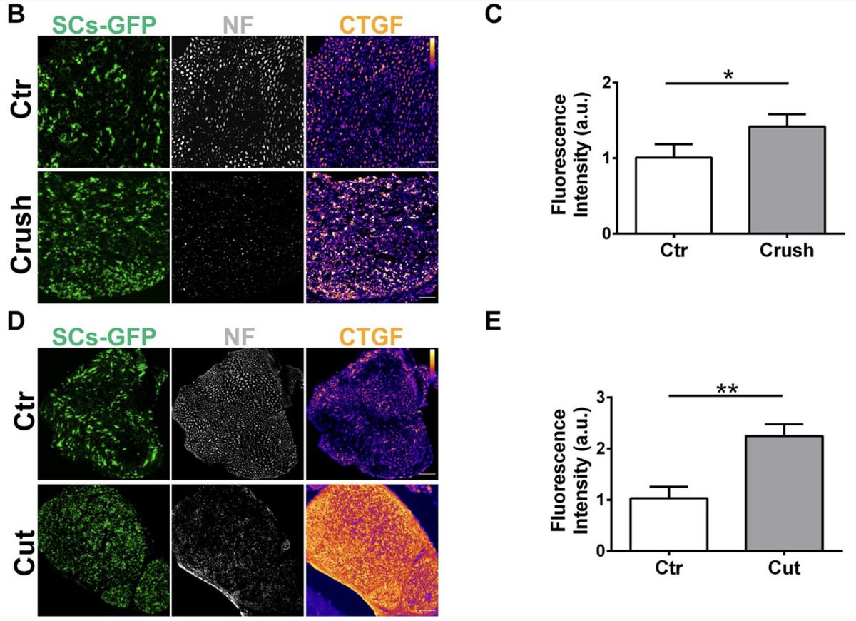 Hydrogen peroxide induced by nerve injury promotes axon regeneration via CTGF

actaneurocomms.biomedcentral.com/articles/10.11…

Nicely done @samuscientist et al., very happy to see this out! @UniPadova @UniTrento @UCLIoN #NerveInjury #SchwannCell #PeripheralNerve #PNS #NMJ